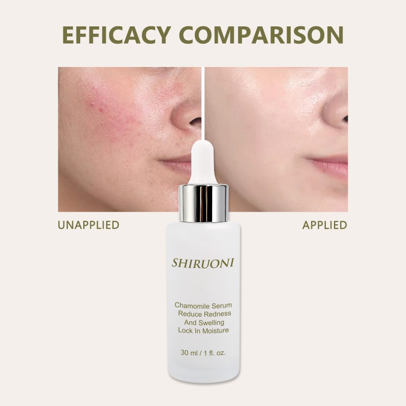 Custom Facial Serum Fine Lines Firming Moisturizing Brightening Deep Hydration Calming Chamomile Serum