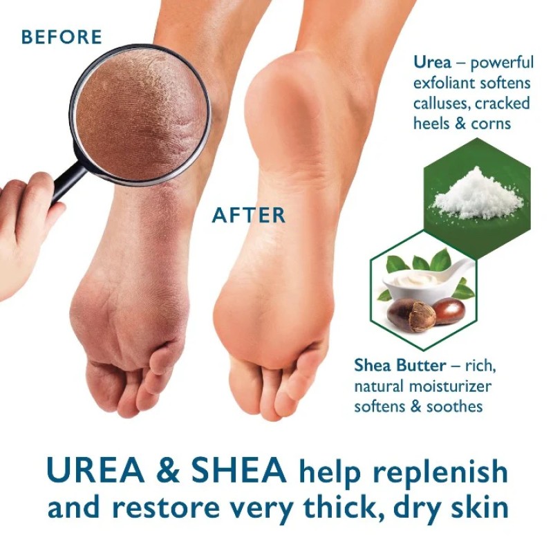 OEM Organic Feet Skin Care Cream Urea 40% Foot Salicylic Acid 2% Repair Cream Moisturizing Soften Cracked Heels