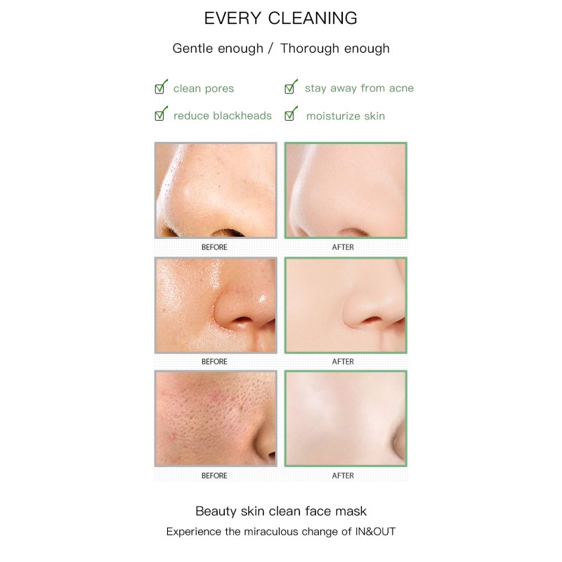 Face Clay Mask Manufacturer - Crystal Skin Care