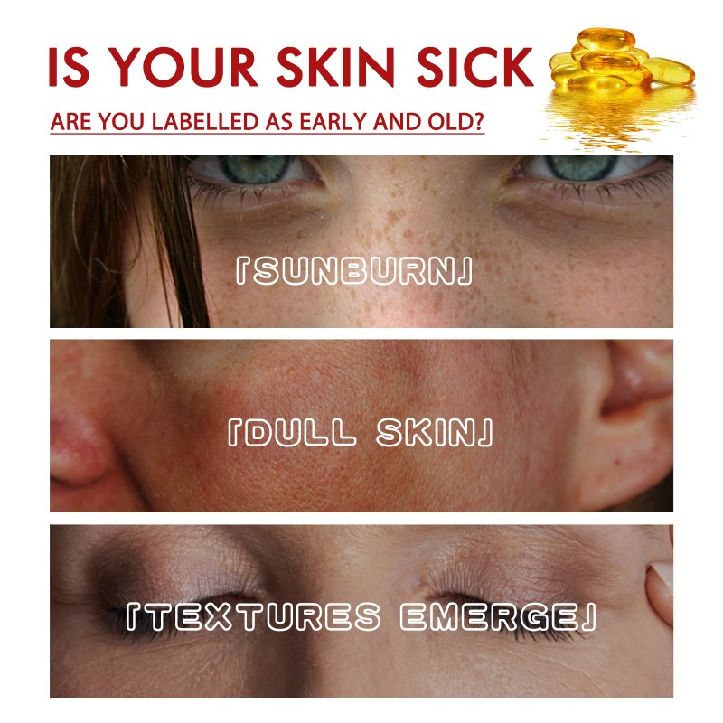 Skin Repair Foundation Manufacturer - Spot Cover