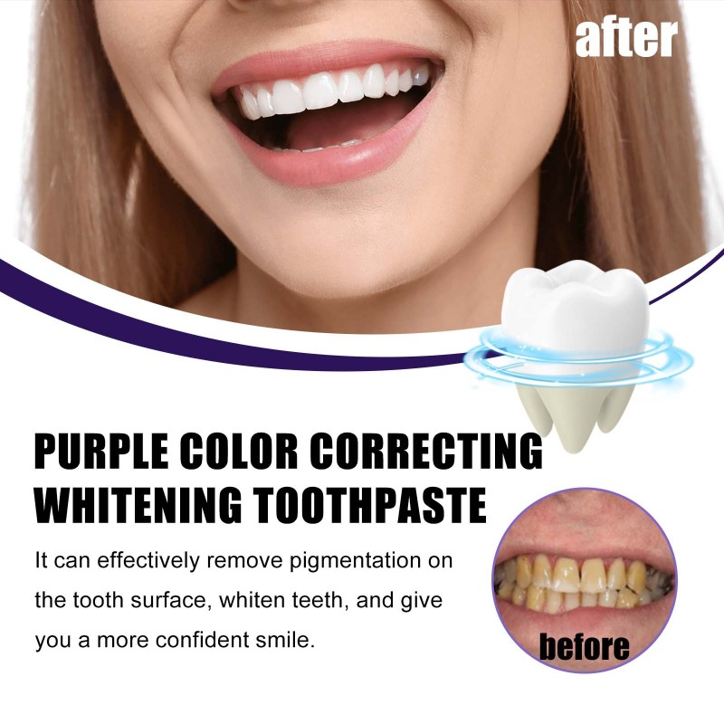 Whitening Toothpaste Manufacturer - Peppermint Natural