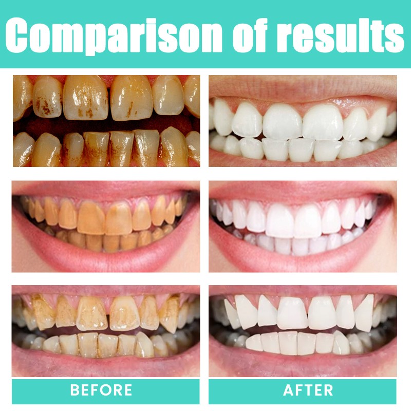 Oil Pulling Manufacturer - Coconut Peppermint