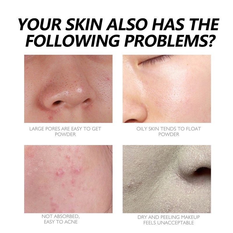 Skin Repair Foundation Manufacturer - Spot Cover