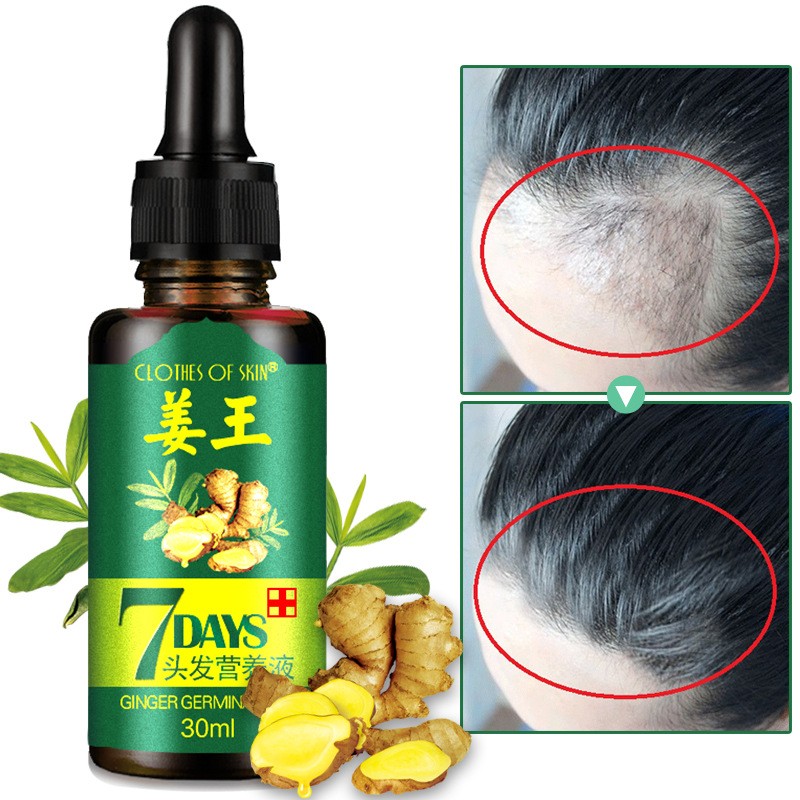 Hair Loss Serum Manufacturer - Organic Ginger