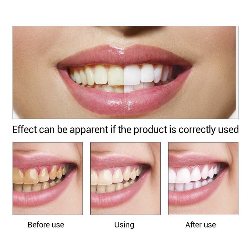 Teeth Whitening Serum Supplier - Beauty Yellow Teeth