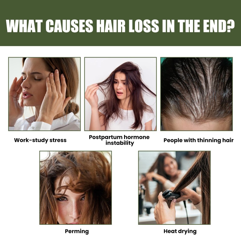 Hair Growth Oil Manufacturer - Rosemary Essential