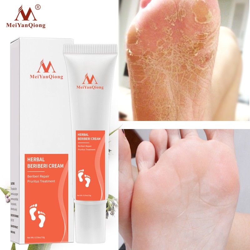 Foot Scrub Supplier - Herbal Anti Fungal