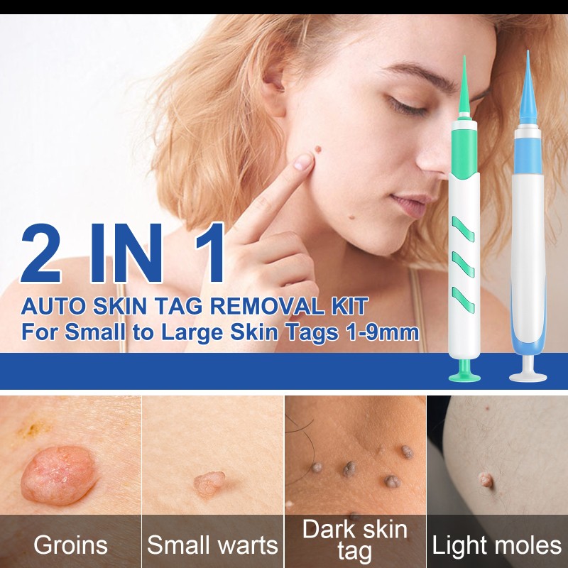 Skin Tag Remover Kit Supplier - Auto Micro