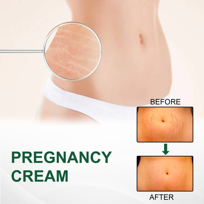 Stretch Mark Cream Factory - Pregnancy Repair