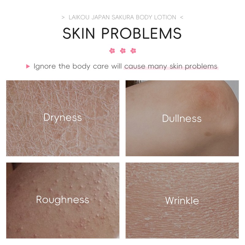 Body Lotion Manufacturer - SAKURA Whitening