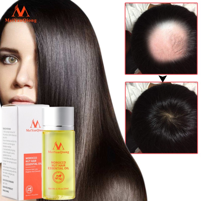 Hair Care Serum Manufacturer - Anti Hair Loss