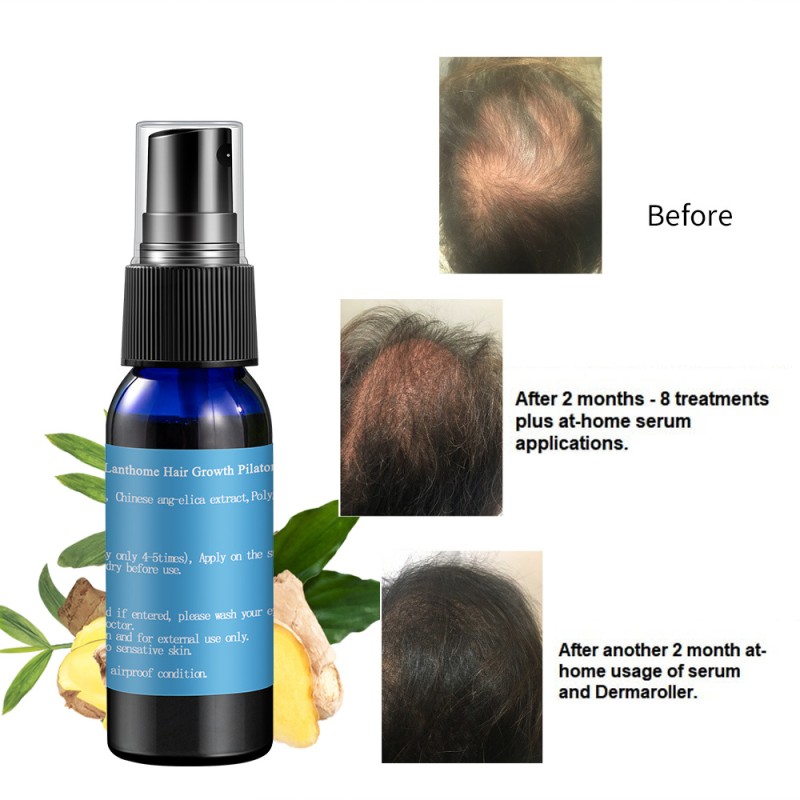 Hair Growth Spray Factory - Root Anti Loss