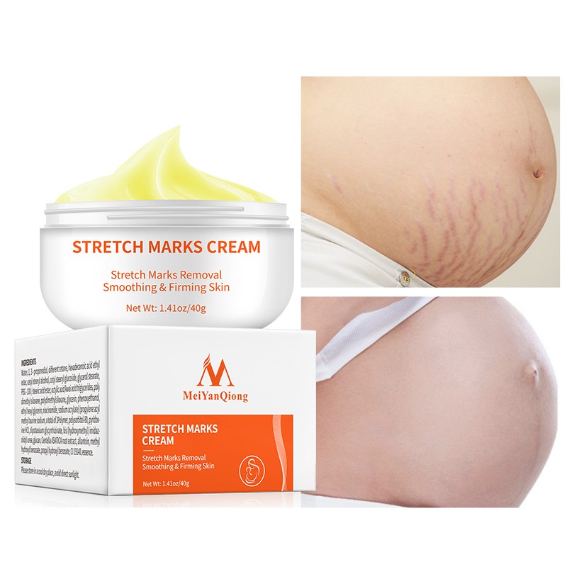 Acne Scar Cream Manufacturer - Tummy Tuck
