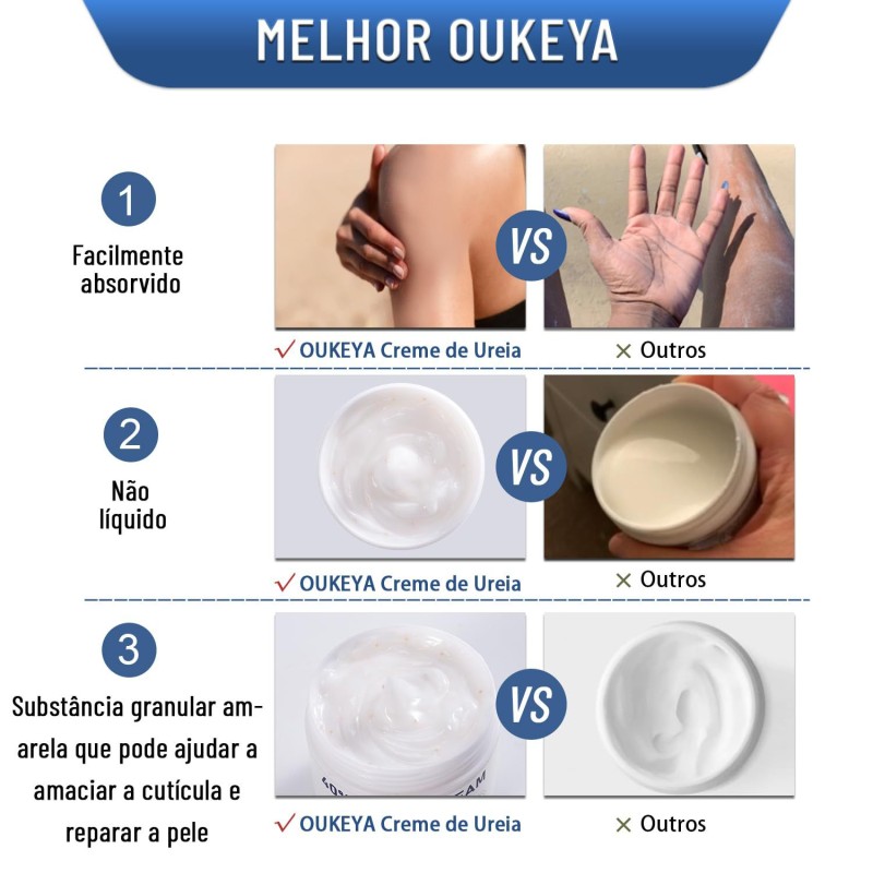 Urea Cream Supplier - 40% Foot Exfoliating