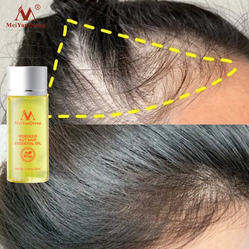 Hair Care Serum Manufacturer - Anti Hair Loss
