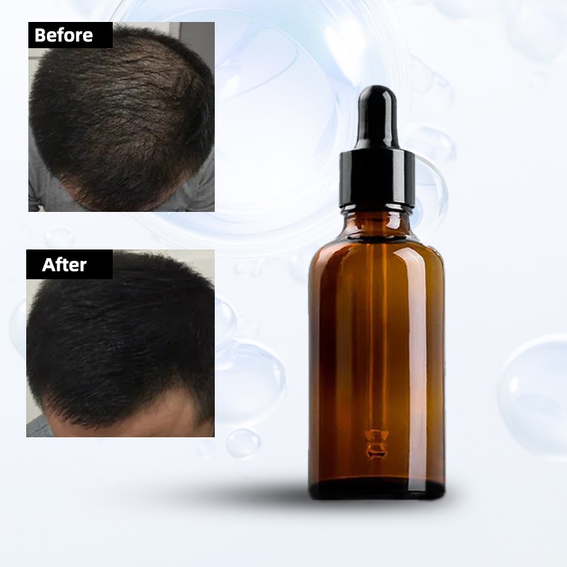 Hair Growth Serum Manufacturer - Private Label Vegan Herbal