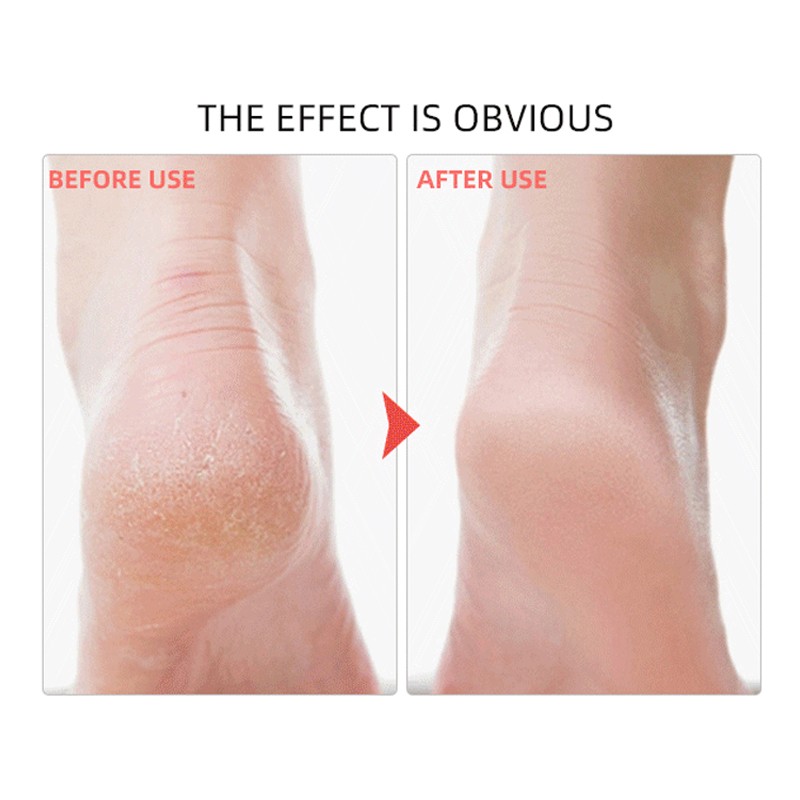 Pedicure Salt Supplier - Crystal Mud Skincare