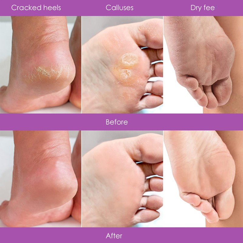 Foot Mud Factory - Vegan Herbal Moisturizing