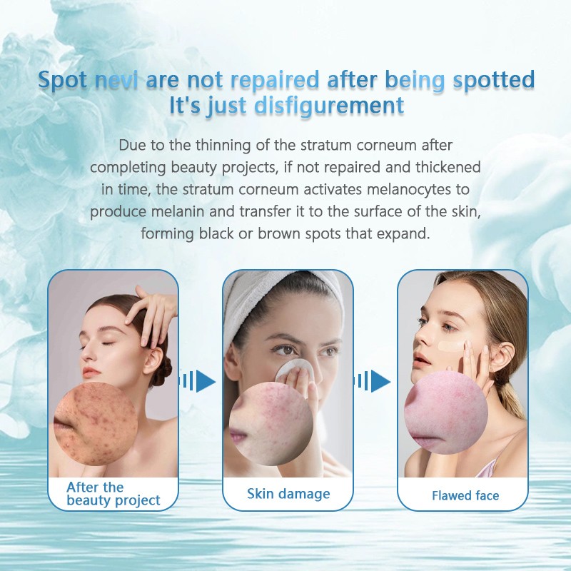 Freeze-Dried Powder Supplier - Acne Repair Custom