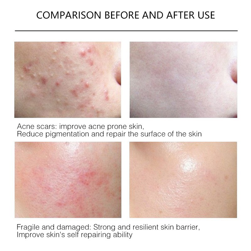 Anti-Wrinkle Serum Manufacturer - Targeted Lyophilized