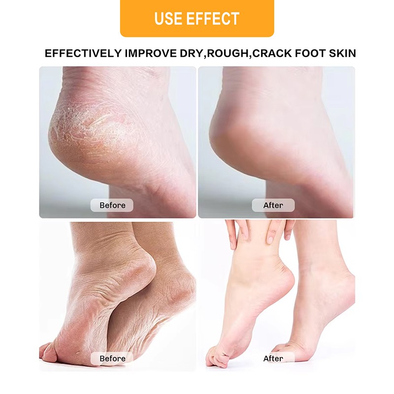 Pedicure Kit Supplier - Hydrotherapy Rose Soak