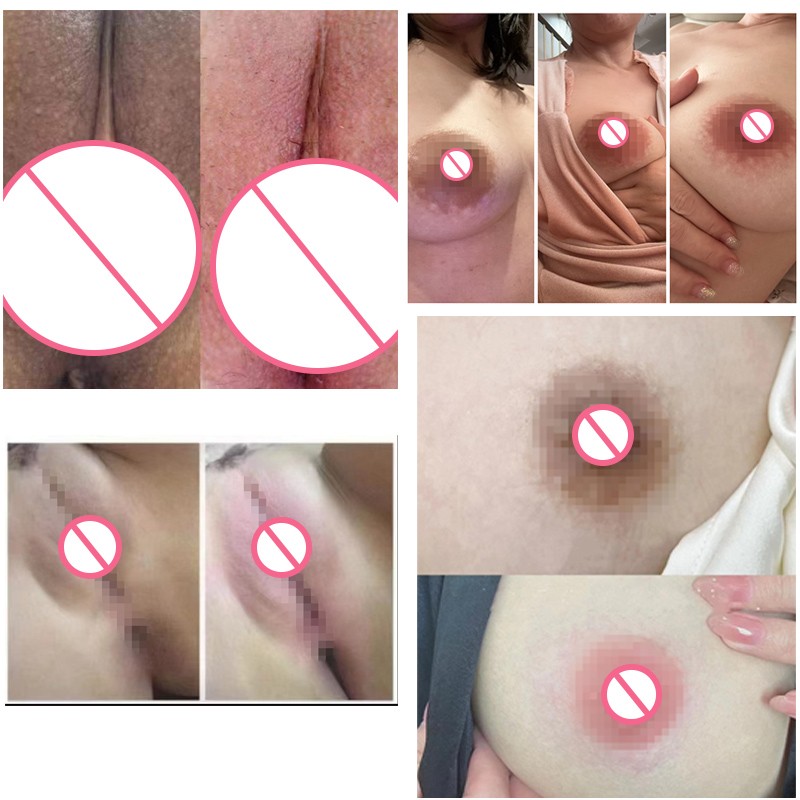 Intimate Area Lightening Cream Supplier - Custom Melanin Reduction