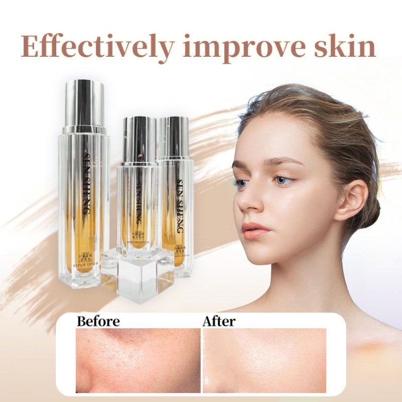 Sensitive Skin Kit Supplier - Calming Repair