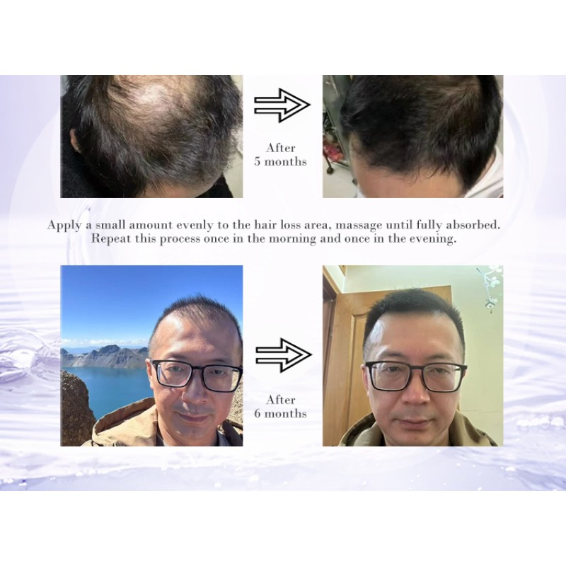 Scalp Essence Supplier - Wig Wearers Care