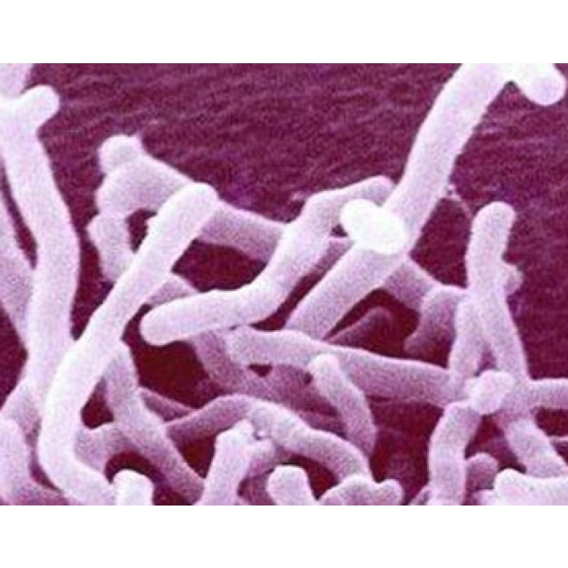 High Activity Food Grade Bifidobacterium Lactis B.lactis Probiotic Powder Raw Material Supply Packaged Bottles Drums Bromelain