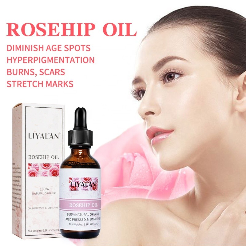 Rosehip Oil Manufacturer - Private Label Unrefined Cold Pressed Anti-Dandruff