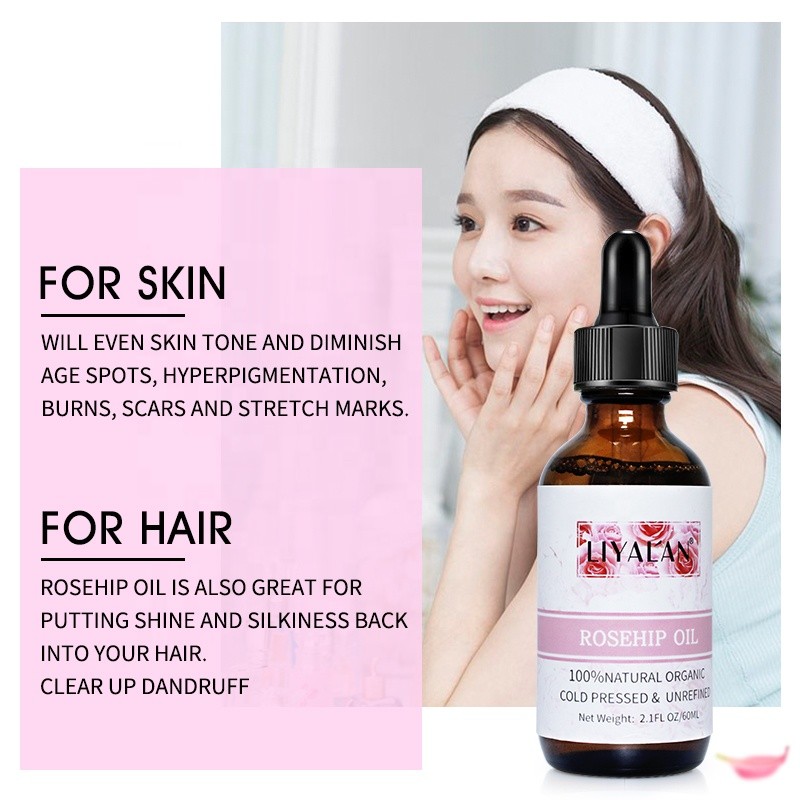 Rosehip Oil Manufacturer - Private Label Unrefined Cold Pressed Anti-Dandruff