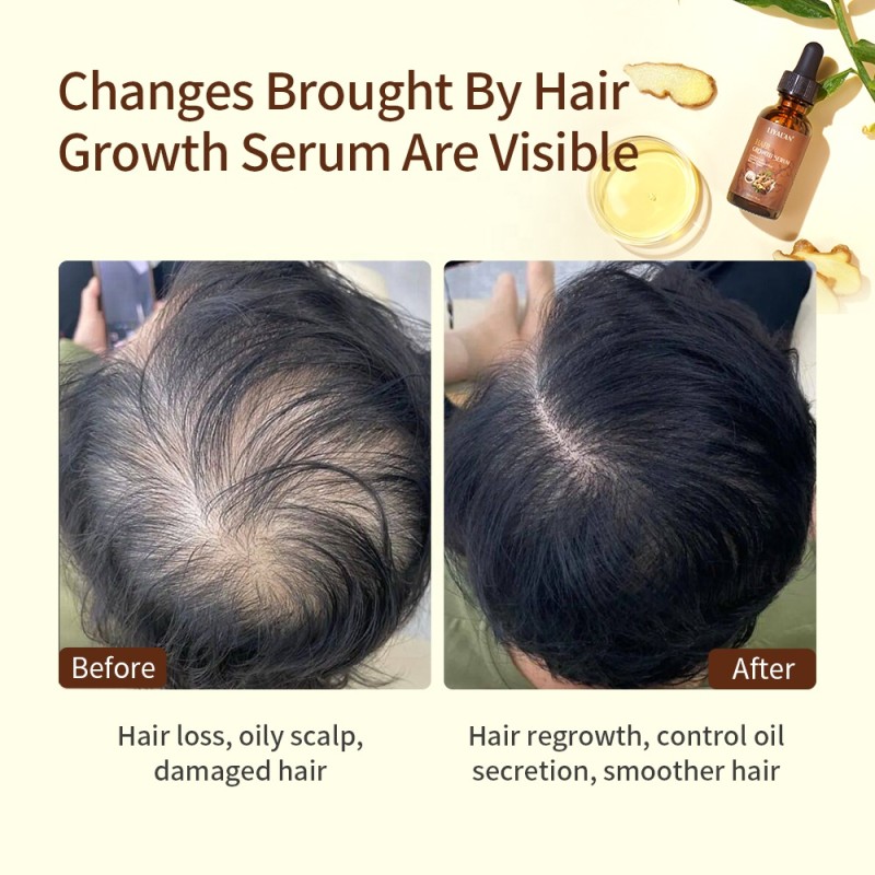 Hair Growth Oil Supplier - Private Label Ginger Scalp Repair Regrowth
