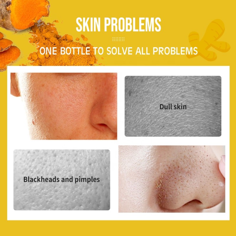 Face Serum Supplier - Private Label Vitamin C Turmeric Anti Acne