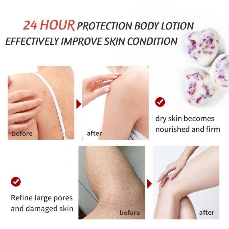 Body Lotion Bars Supplier - Custom Moisturizing Soothes Dry Skin Shea