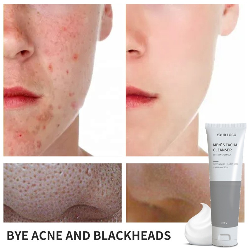 Facial Cleanser Factory - Private Label Hydrating Anti-acne Oil Control Men