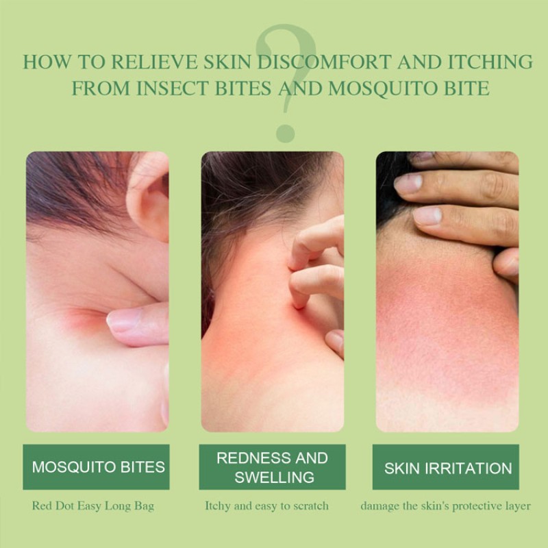 Itching Balm Supplier - Natural Extract