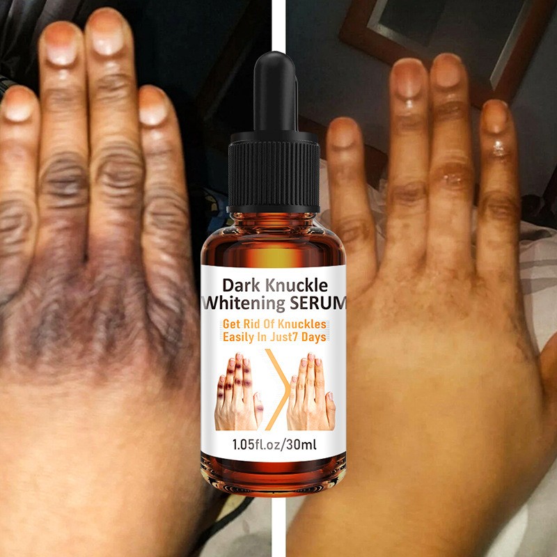 Whitening Essence Factory - OEM Custom Melanin Removal