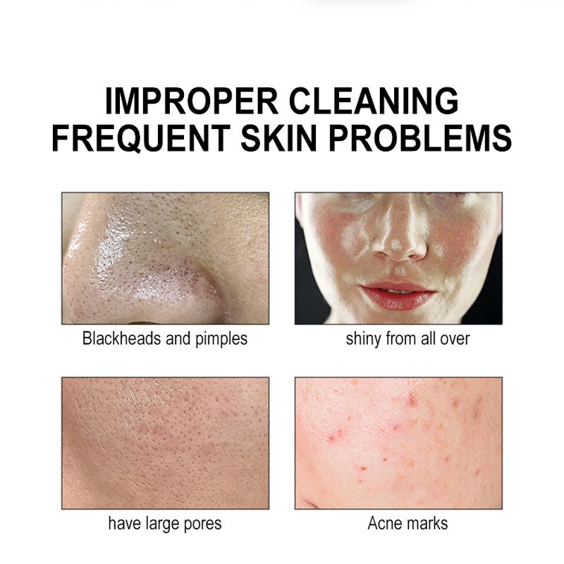 Cleansing Mousse Manufacturer - OEM Custom Gentle Foam Cleanse