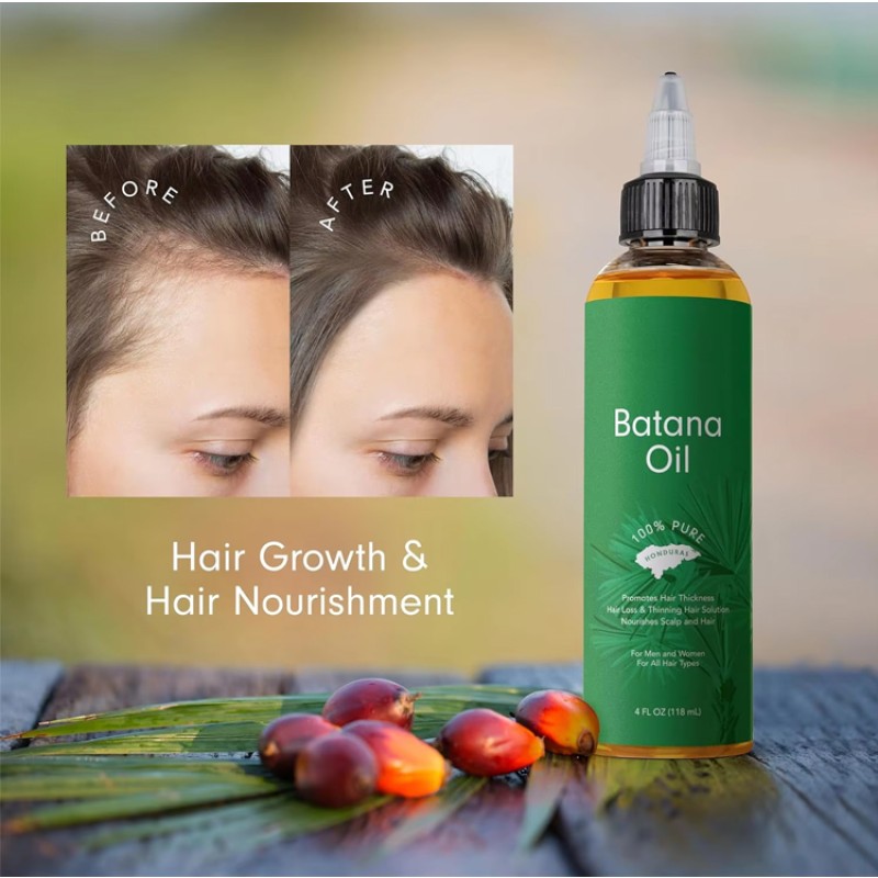 Batana Oil Manufacturer - OEM Custom Pure Natural Hair Care