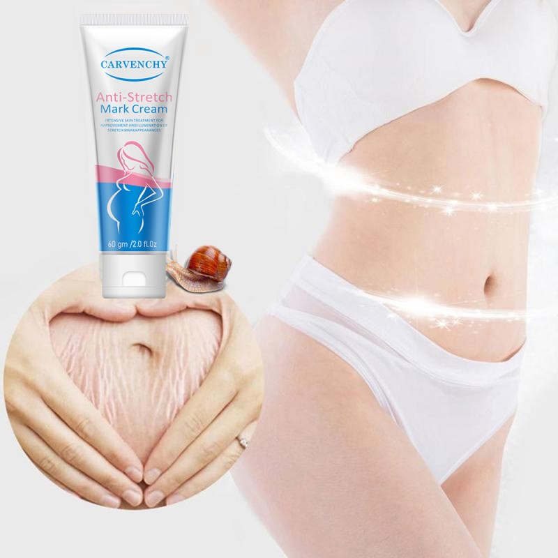 Stretch Mark Cream Manufacturer - OEM Custom Pregnancy Repair