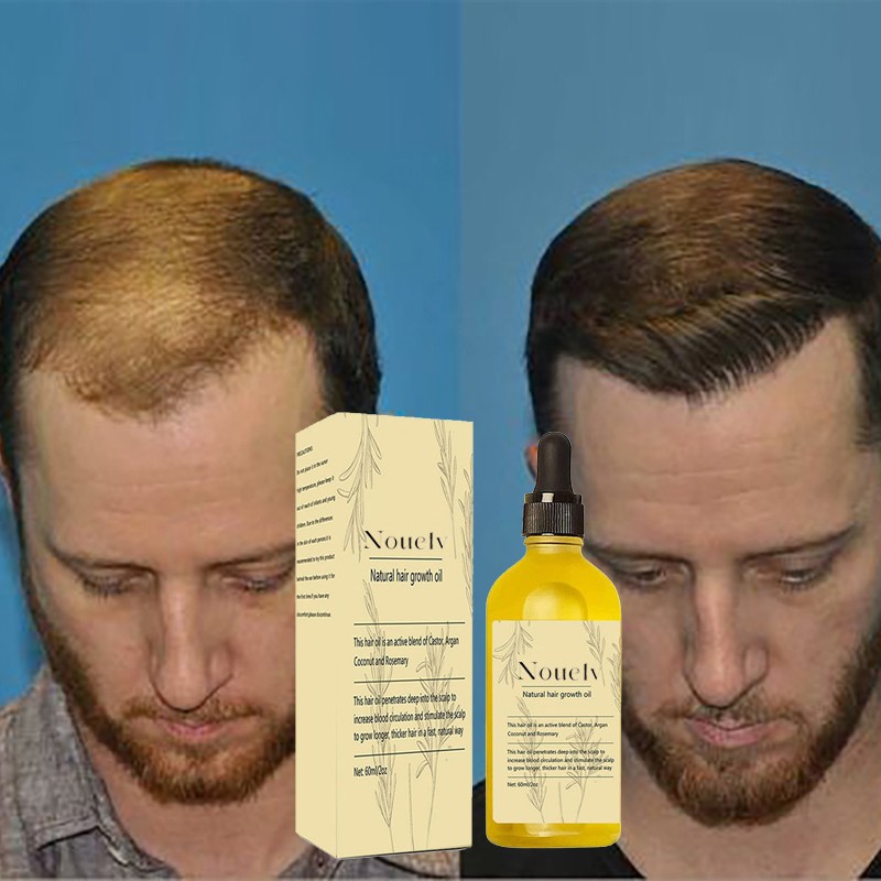 Hair Growth Oil Manufacturer - OEM Custom Rosemary Castor Argan