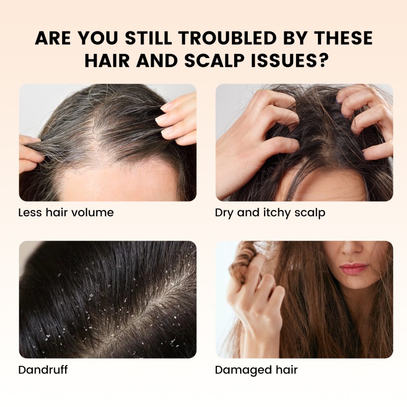 Hair Care Oil Factory - OEM ODM Herbal Rosemary Nourishing