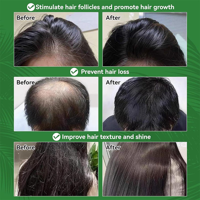 Batana Oil Manufacturer - OEM Custom Anti Hair Loss Care