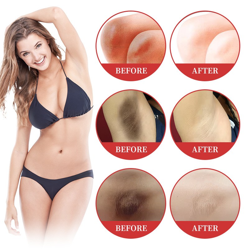 Body Lightening Cream Factory - OEM ODM Herbal Desalination