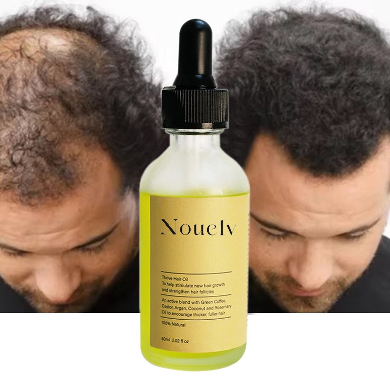 Hair Oil Factory - OEM Custom Organic Herbs Scalp Care