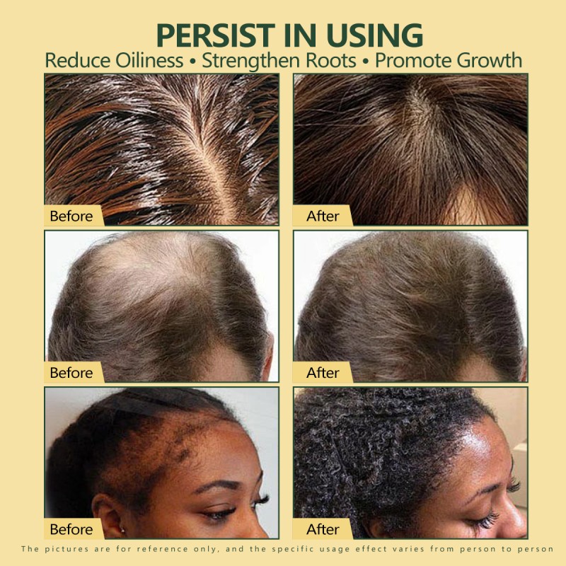 Hair Shampoo Manufacturer - OEM ODM Organic Rosemary Repair