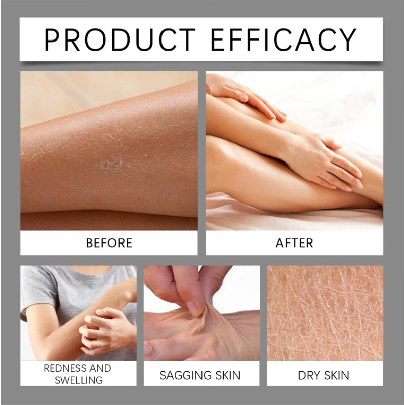 Skin Cream Manufacturer - OEM Custom Natural Yam Root