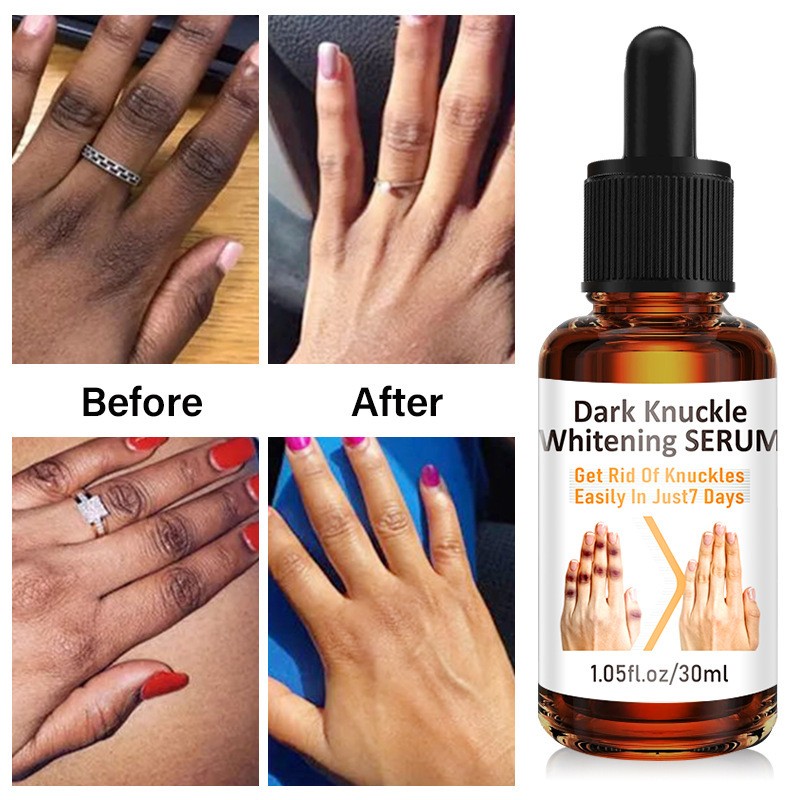 Whitening Essence Factory - OEM Custom Melanin Removal
