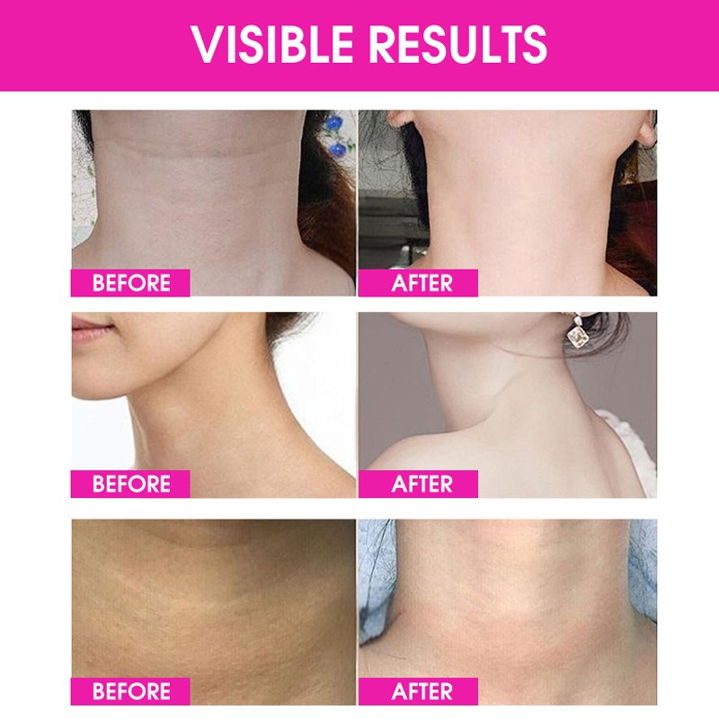 Neck Cream Factory - OEM Custom Firming Wrinkle Reduce