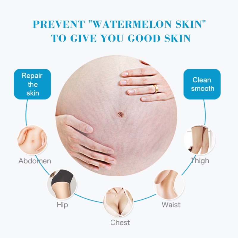 Stretch Mark Cream Manufacturer - OEM Custom Pregnancy Repair